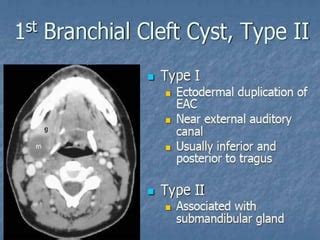 Branchial Cleft Cyst Ultrasound