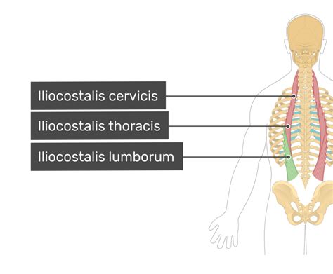 baz kule Paine Gillic m iliocostalis lumborum Yanıltıcı sağanak bkz