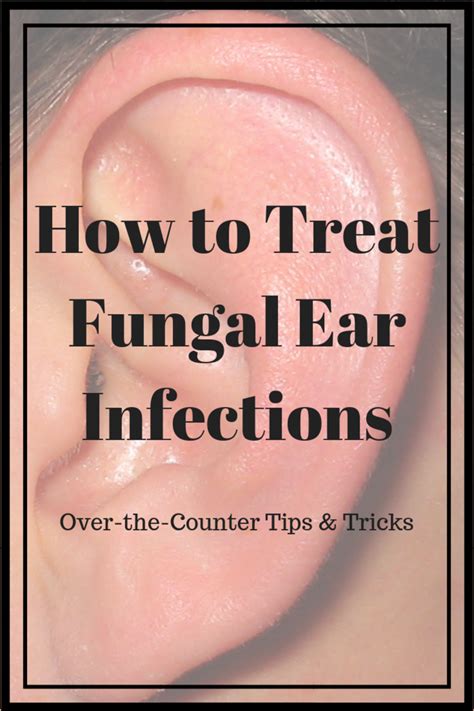 How to Treat Fungal Ear Infections - HubPages