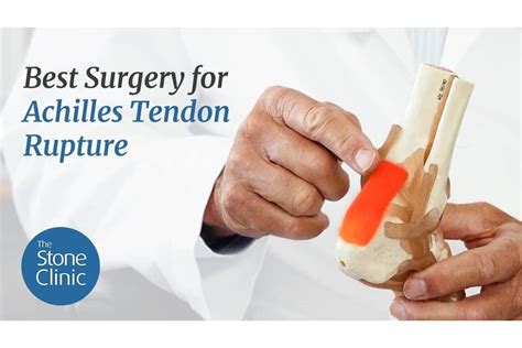 Best Surgery for Achilles Tendon Rupture (Video Blog)