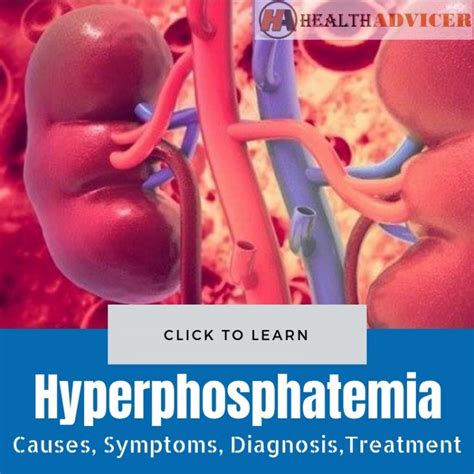 Hyperphosphatemia: Causes, Symptoms, Diagnosis And Treatment