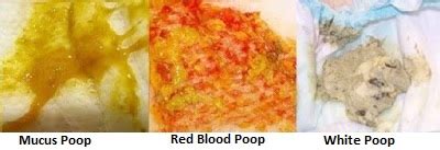 Bloody Mucus In Baby Stool | Wonder Wifey