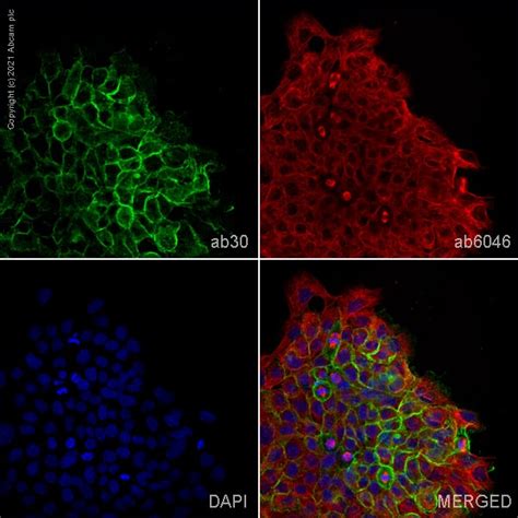 Results for "EGFR" | Abcam: antibodies, proteins, kits...