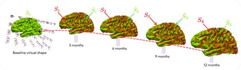 The Healthy Brain - Web