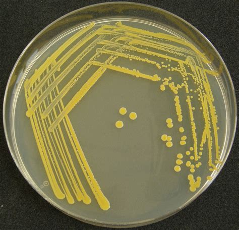 Staphylococcus aureus na GTK agaru