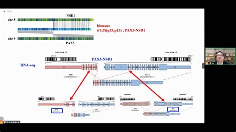 Bionano Optical Genome Mapping to Decipher Genomic Structure Variations in Acute Leukemias ...