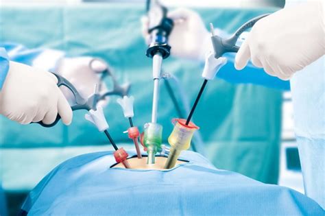 Laparoscopy surgery | Laparoscopic Surgeon in Sharjah, Dubai