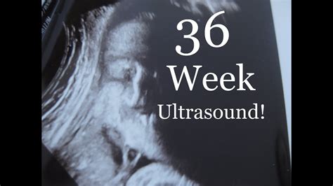 36 Week Ultrasound - Baby's Health, Size and Labour Implications - YouTube