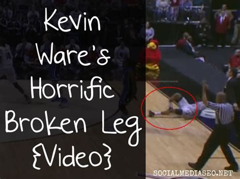 Kevin Ware Broken Leg Video - Louisville Basketball Player Injury