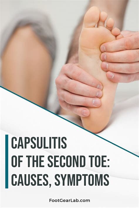 Capsulitis of the second toe causes symptoms and treatments – Artofit