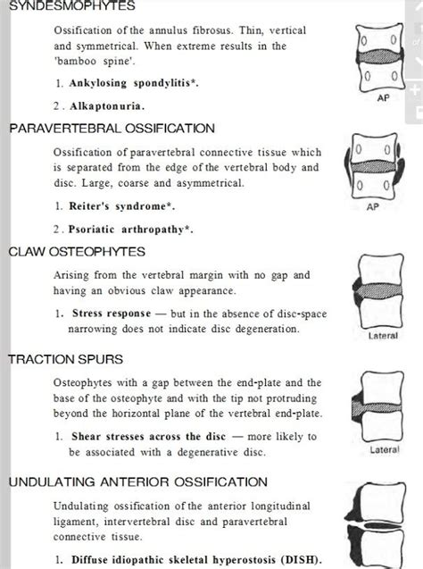 enthesophyte vs osteophyte vs syndesmophytes - Google Search Radiology ...