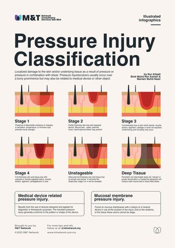 Pressure Injury Classification | M&T Network