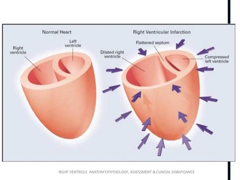 Right ventricle (RV) anatomy and functions