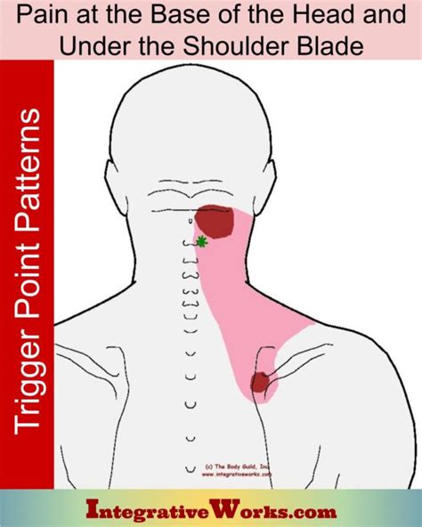 Pain Between Shoulder Blades: Pain Patterns, Causes, Self-Care ...