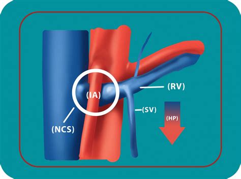 Causes & Treament of Varicocele | Georgiadis Urology