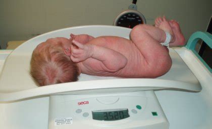 Birth weight and adult disease are genetically linked, study finds - UQ News - The University of ...