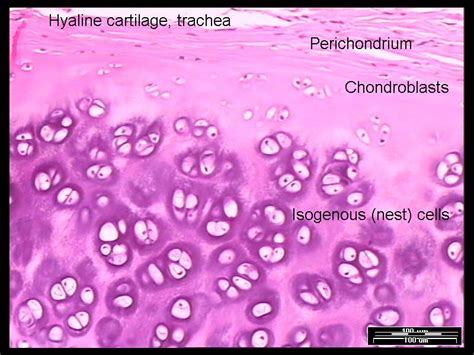 hyaline cartilage | Hyaline cartilage, Cartilage, Human tissue