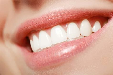 3 Ways Perfect Teeth for Gorgeous Smile- Florida Independent