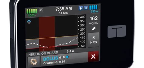 Tandem shapes FDA strategy for new insulin pump features – gr-cis.com