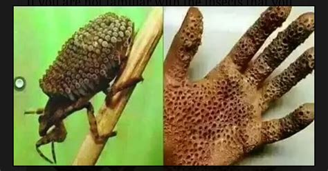 In Case You Missed: WARNING: Killer Insect Burns Skin Like Acid, Causing Death Within Days – Don ...