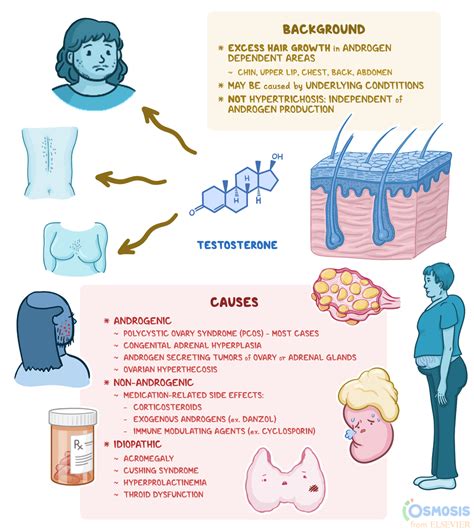 Hirsutism: What Is It, Causes, Treatment, and More | Osmosis