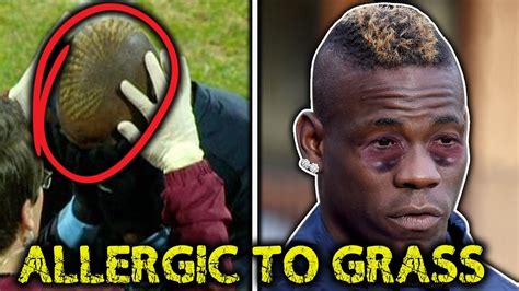 10 Most RIDICULOUS Football Injuries!