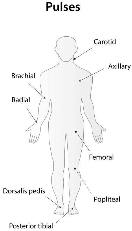 What is a Femoral Pulse? (with pictures)