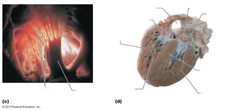Papillary Muscles Diagram | Quizlet