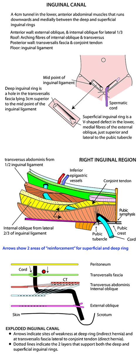 Inguinal Canal Anatomy Female / PPT - Inguinal , femoral and scrotal ...