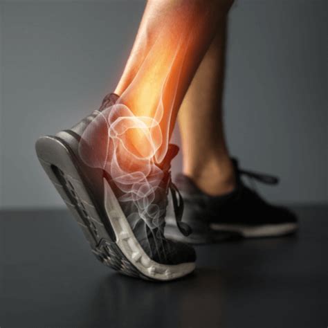 Information & Exercises to Combat Your Chronic Ankle Pain | PARR PT