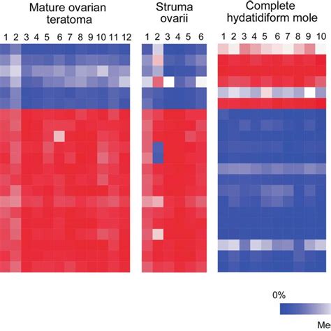 Methylation status of imprinting control regions (ICRs) of imprinted ...