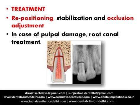 Tooth Injuries| Tooth Trauma| Treatment of Tooth Trauma