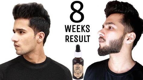 The Man Company Beard Oil Growth Results | How to apply beard oil | Before and After - YouTube