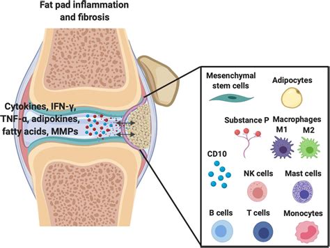 Frontiers | Infrapatellar Fat Pad/Synovium Complex in Early-Stage Knee Osteoarthritis: Potential ...