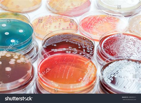 497 Positive blood culture Images, Stock Photos & Vectors | Shutterstock