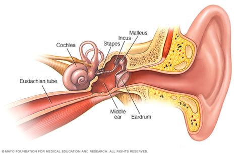 Rotura del tímpano (perforación del tímpano) - Síntomas y causas - Mayo Clinic