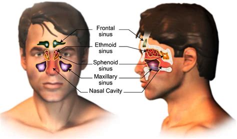 Paranasal-Sinuses-Cancer-Treatment-in-India-Cost-Treatment-Surgery-Top-Hospital-Best-Doctors-in ...