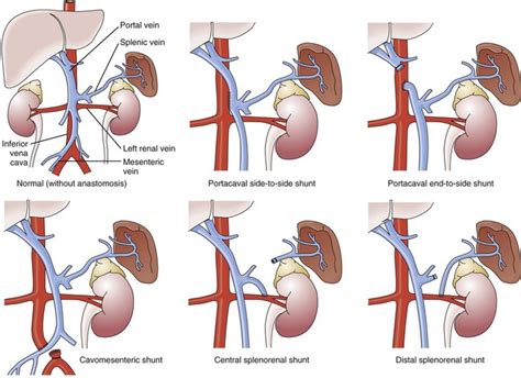 Gastrointestinal Disorders and Therapeutic Management | Nurse Key