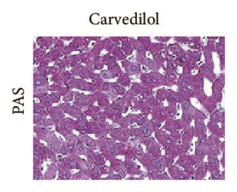 Analysis of the histological structure of the hepatic parenchyma after ...