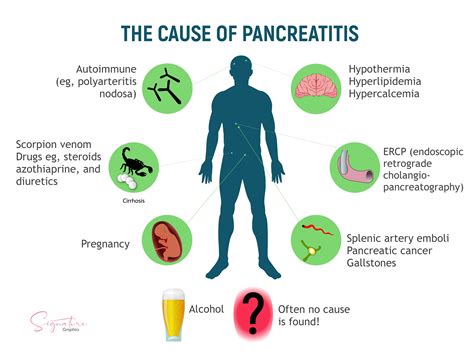 Pancreatitis Symptoms Causes Treatment - vrogue.co