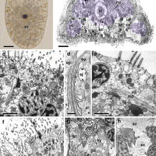 Structure of synapses. a Asymmetric synapse showing small clear ...