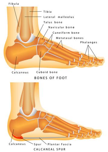 Podiatry Heel Spurs/Plantar Fasciitis in Baltimore, MD | Hamilton Foot Care