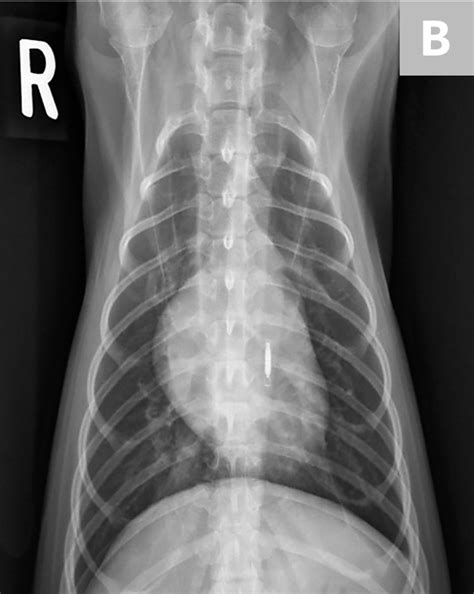 Ventrodorsal thoracic radiograph Diagram | Quizlet