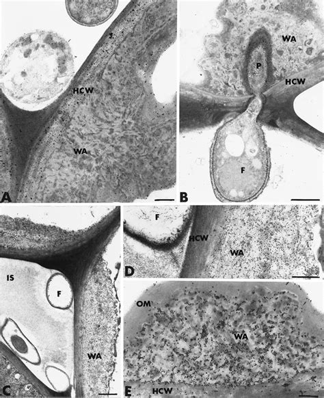 Transmission electron micrographs of Pythium oligandrum-inoculated... | Download Scientific Diagram