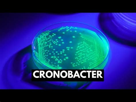 Cronobacter Sakazakii: Characteristics, Diseases - science - 2024