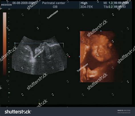 A 3d Ultrasound Of A 27 Week Old Baby. Stock Photo 40623568 : Shutterstock