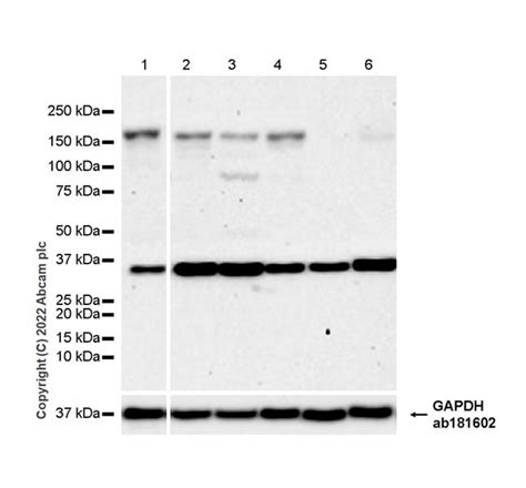 Recombinant Anti-FGF23 antibody [EPR25309-57] (ab307420) | Abcam