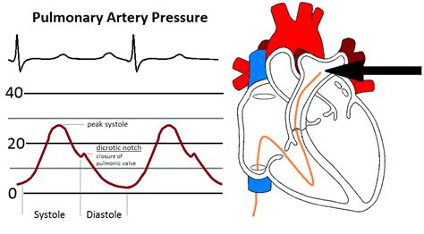 Image result for PAP waveform | School hacks, Cardiovascular system ...