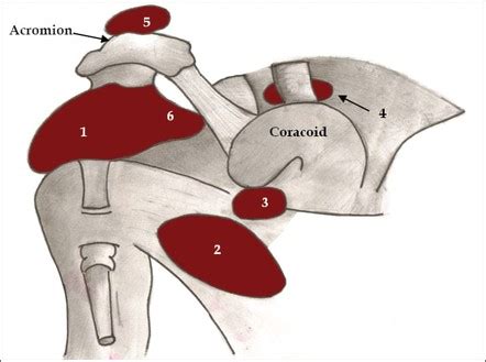 Shoulder bursae | Radiology Reference Article | Radiopaedia.org
