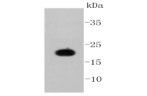 Anti-Caveolin-1 Antibody (A32334) | Antibodies.com